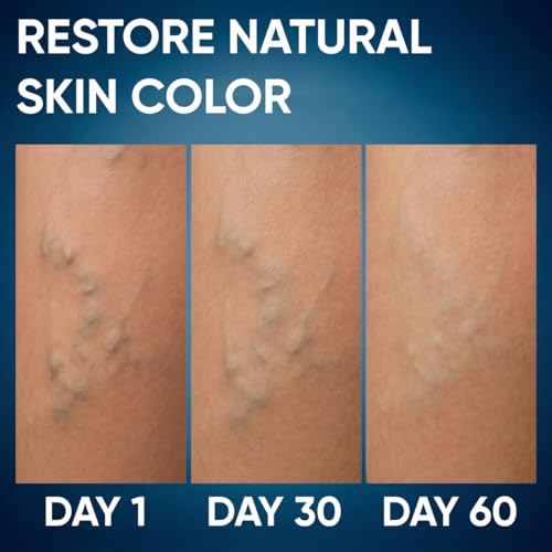 PENIKOSETE Ayurvedic Botanical Leg Cream with Ashwagandha