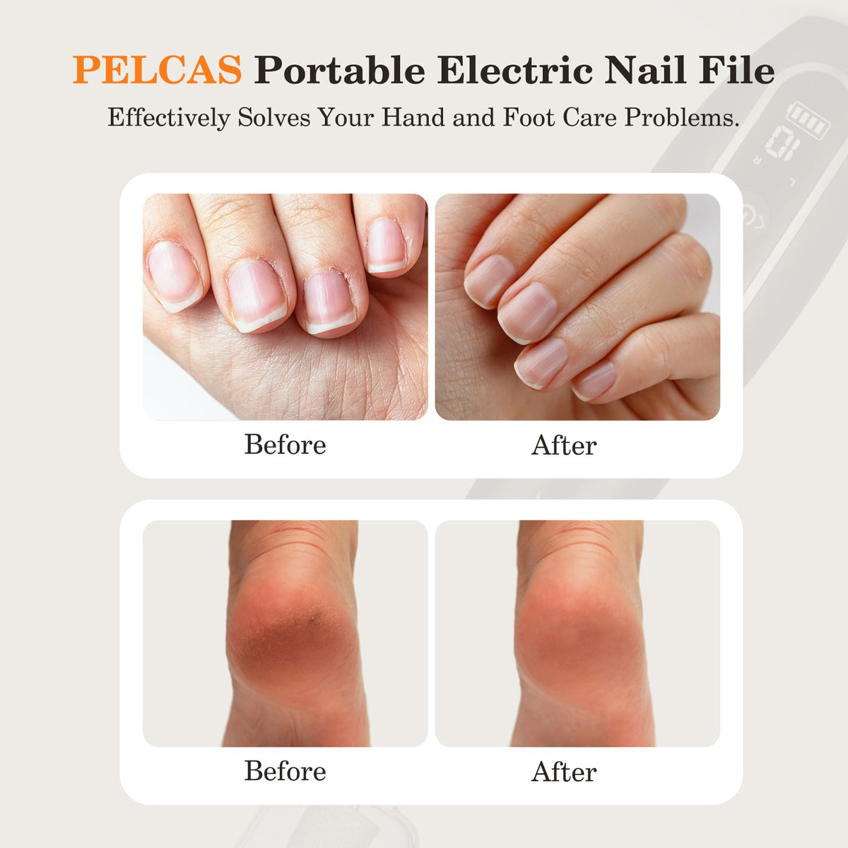 PELCAS Cordless Electric Nail Drill Kit with Light, LCD Display and 10 Speeds