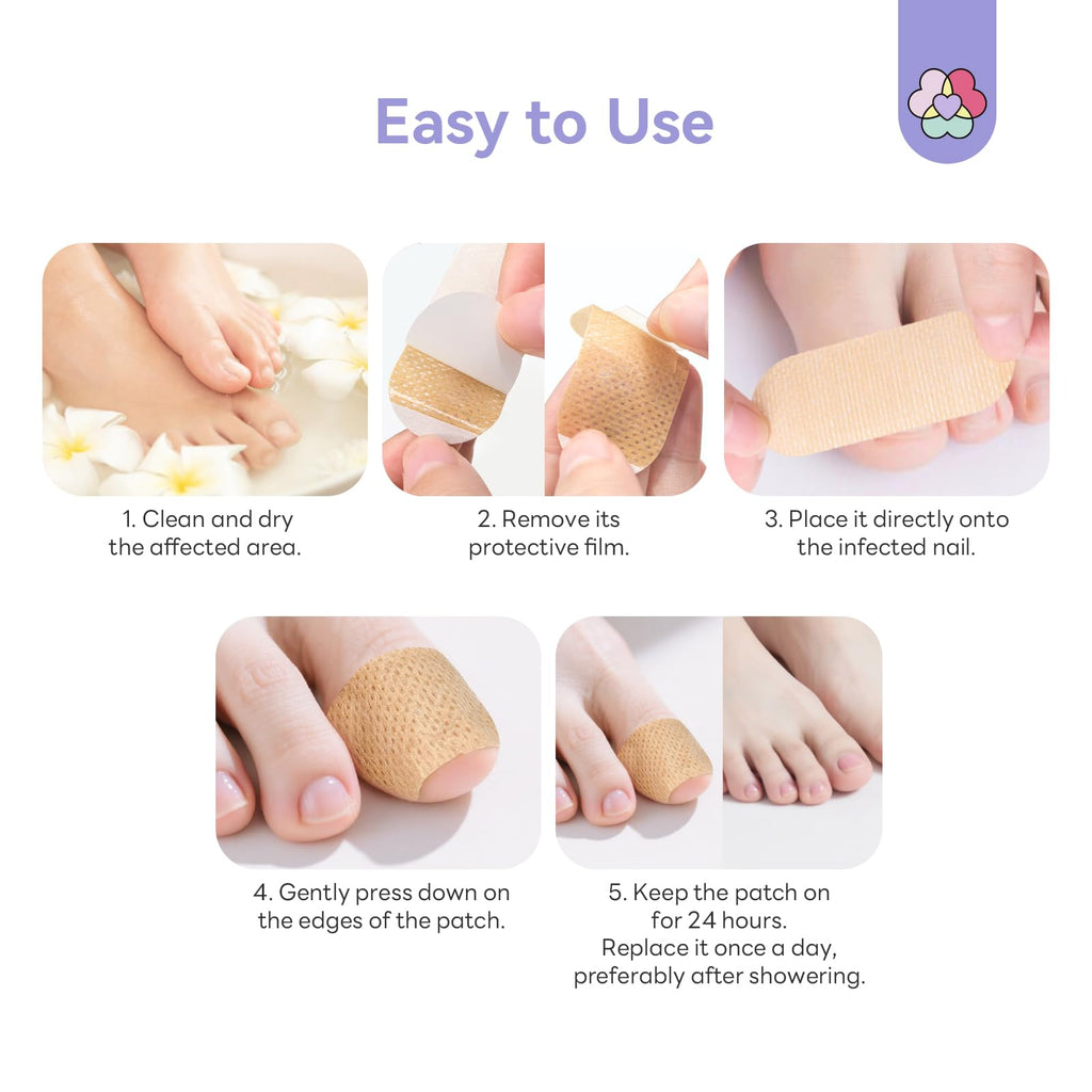 SAVILAND Fungal Nail Patches with 1% Tolnaftate