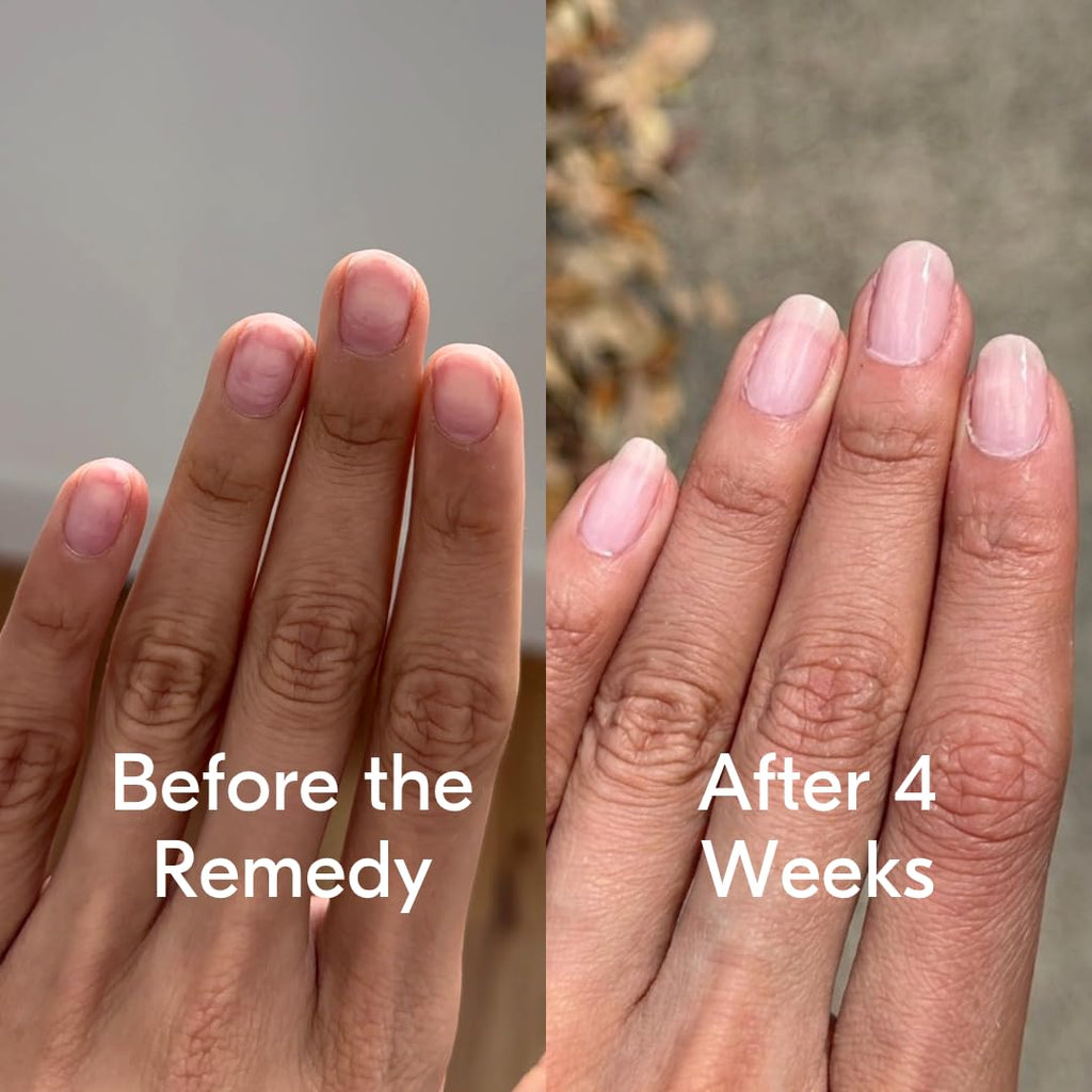 Botanist The Remedy Nail Strengthening Polish