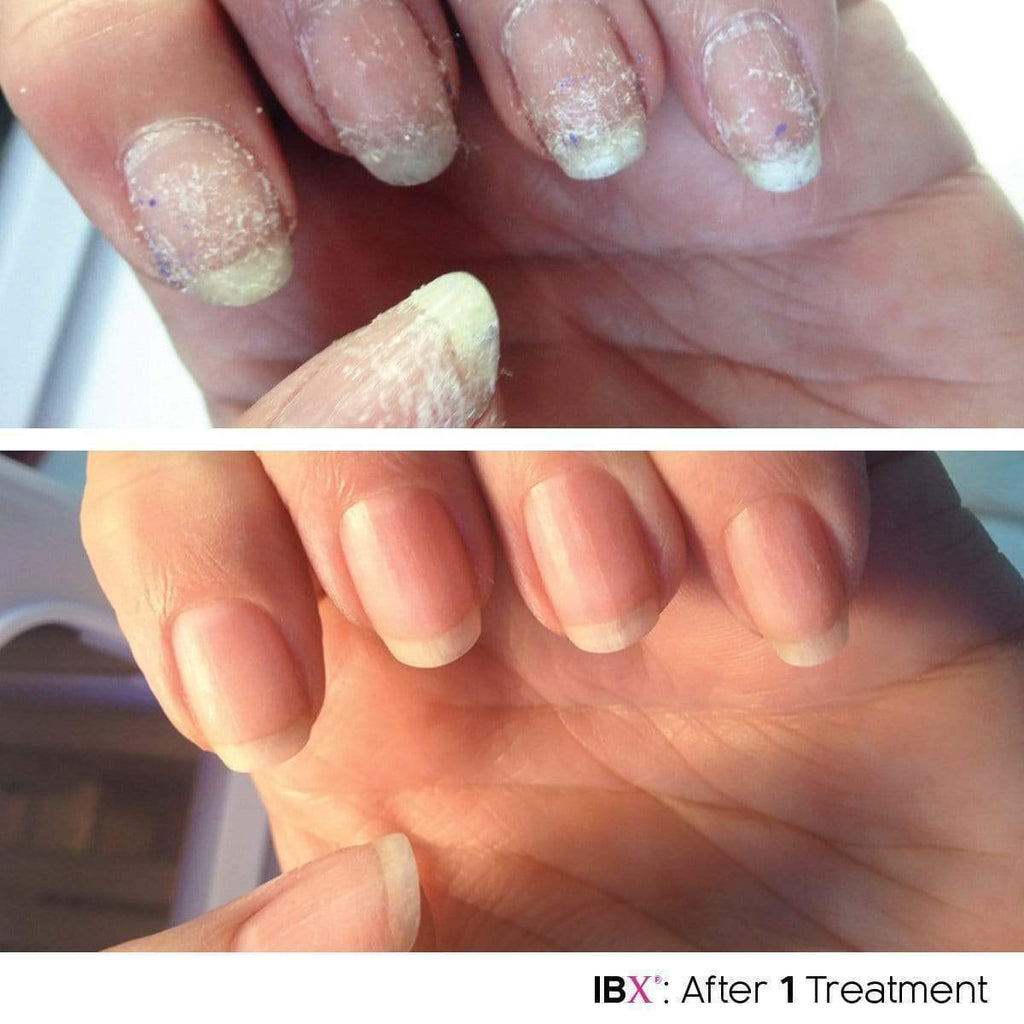 IBX Duo Mini Professional Nail Repair and Strengthening System
