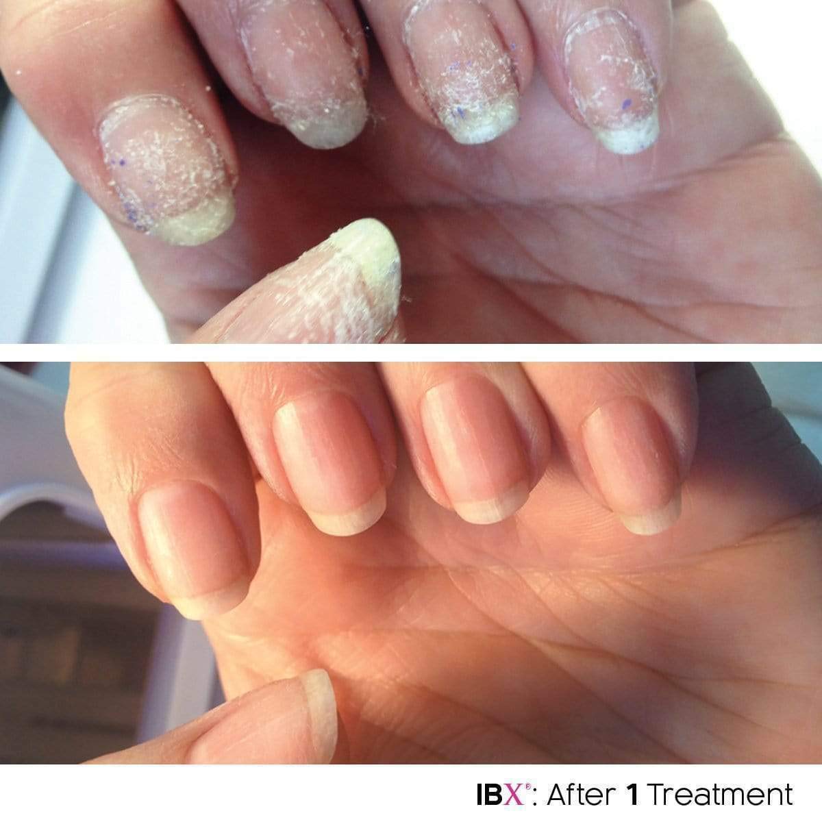 IBX Duo Mini Professional Nail Repair and Strengthening System