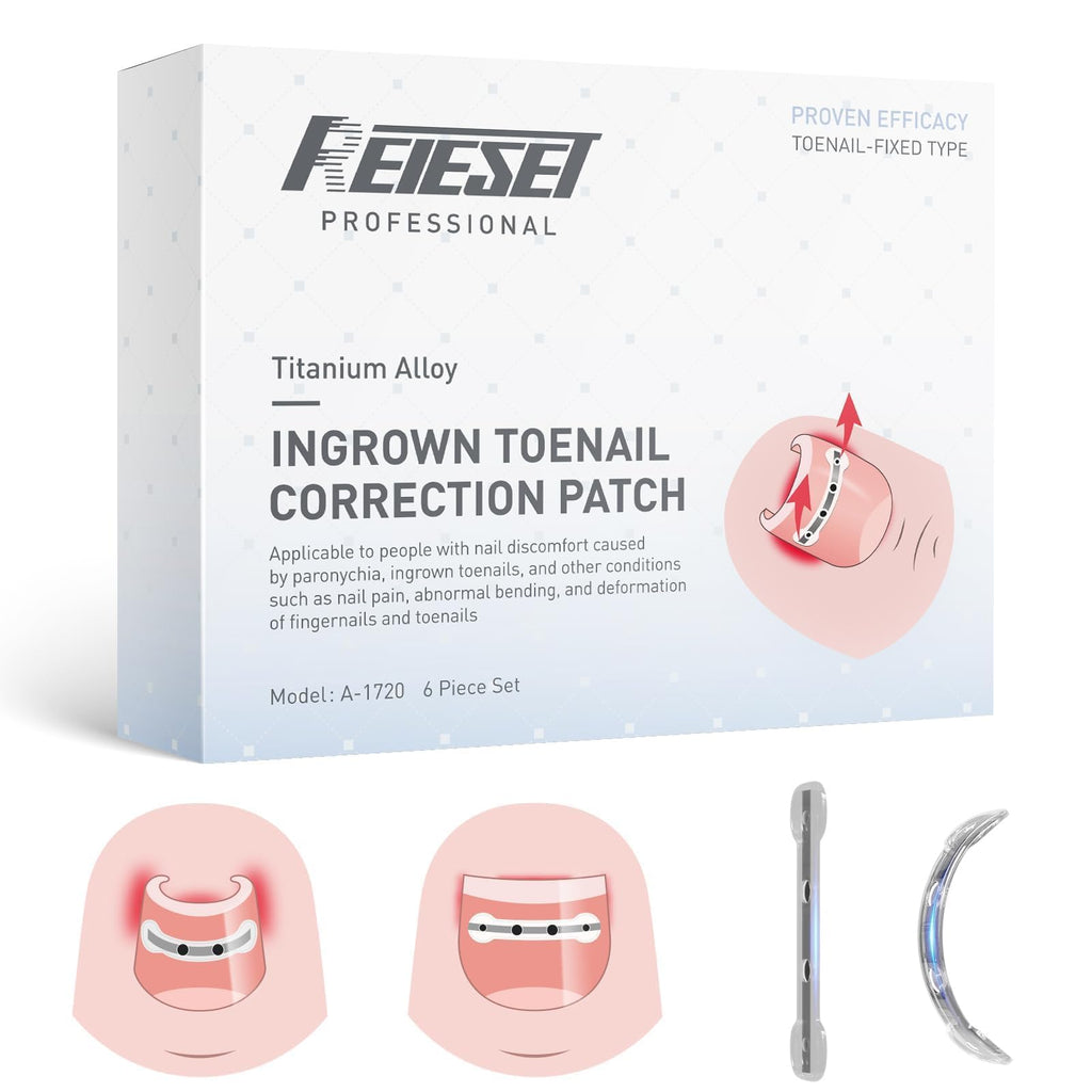 Reieset Titanium Alloy Ingrown Toenail Correction Patch