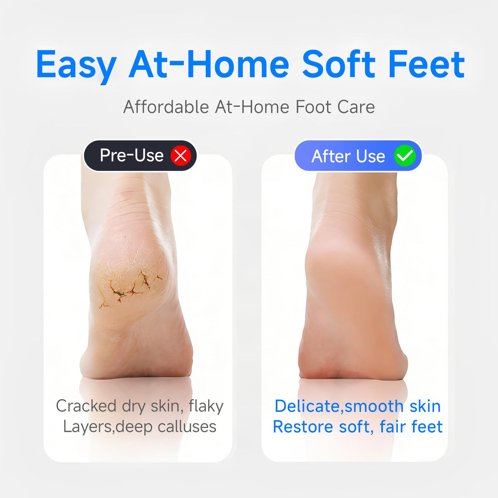 Electric Foot Callus Remover, 30000Pa Rechargeable Pedicure File