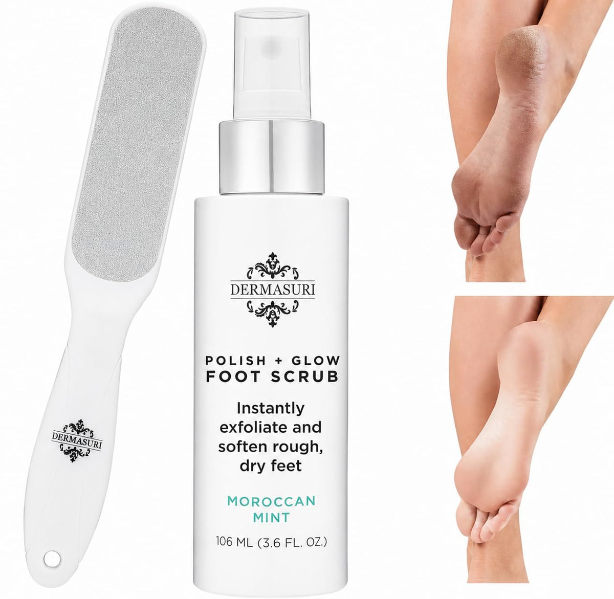 Dermasuri Callus Remover Foot Scrub & Reusable Deluxe Foot File Kit