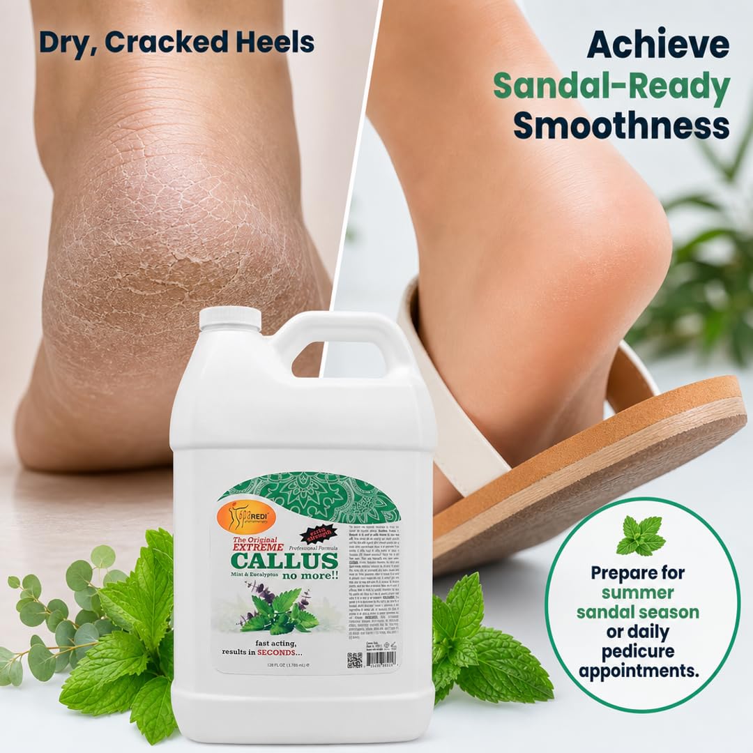 SPA REDI Foot Callus Remover Gel