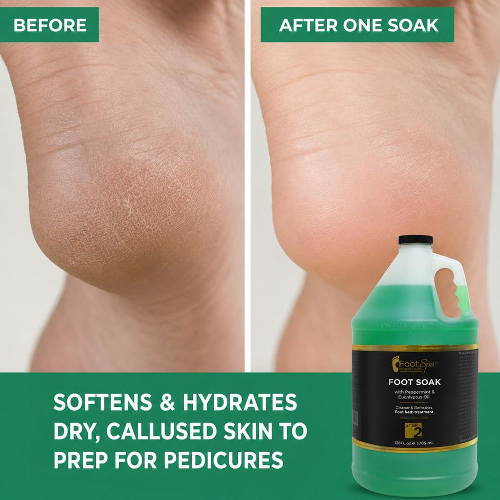 Foot Spa Foot Soak with Eucalyptus and Peppermint Oil, 128 Oz Gallon