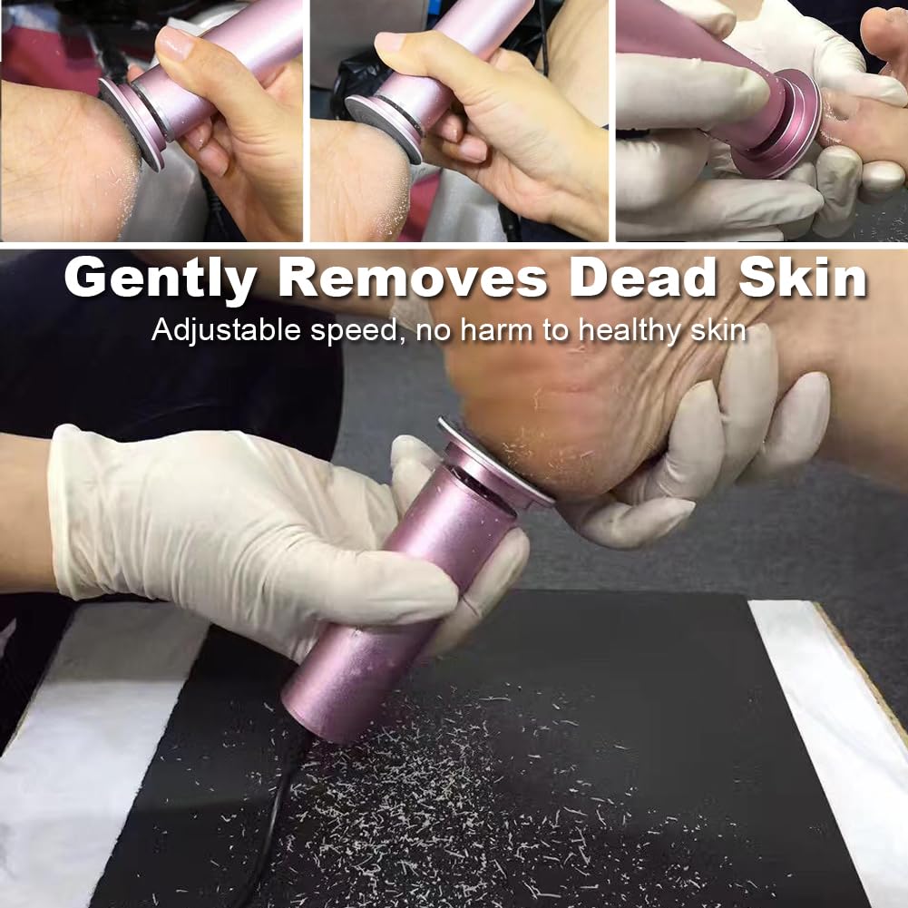 I.B.N Electric Foot Callus Remover with Adjustable Speed