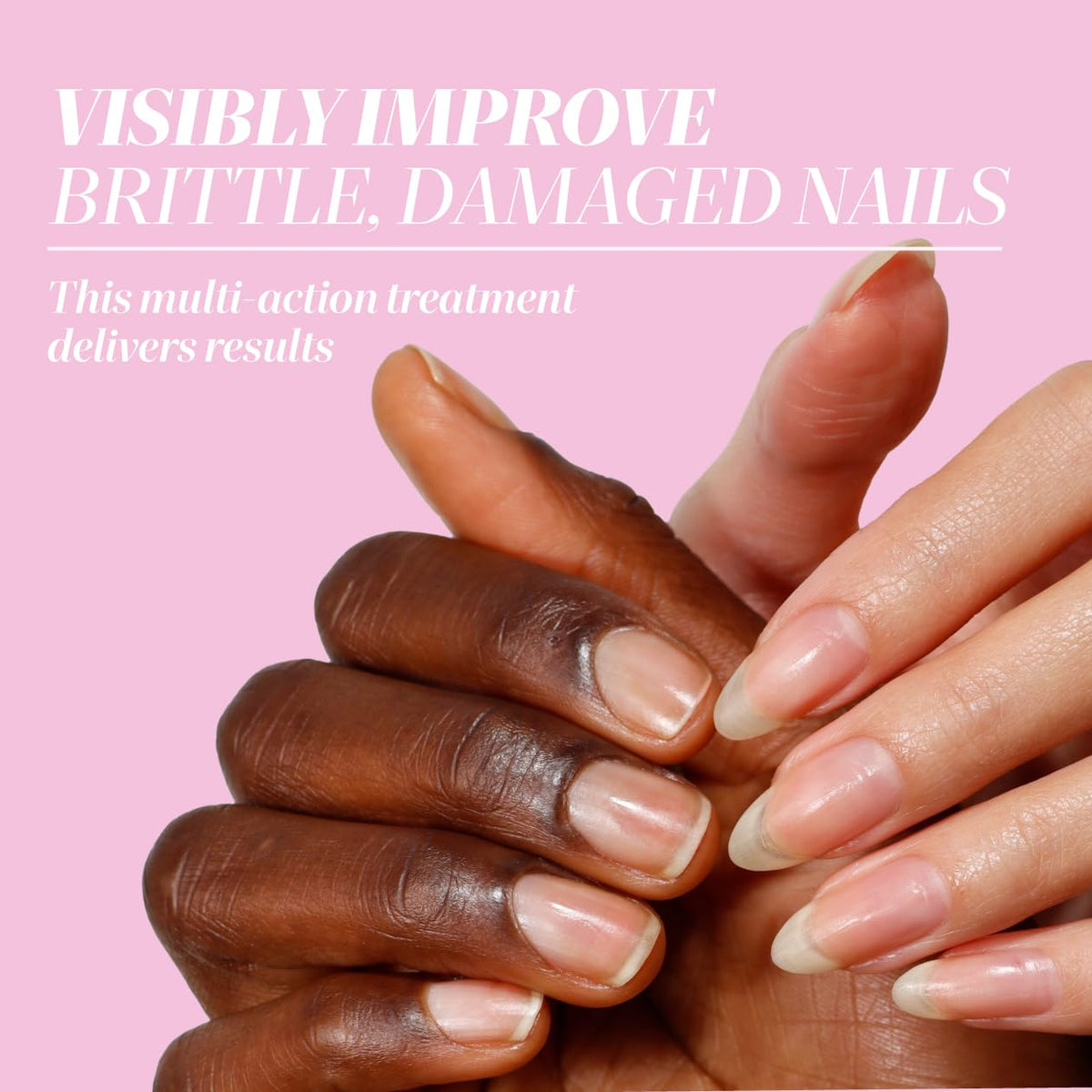 LONDONTOWN Get Well Nail Recovery Treatment for Weak, Damaged Nails