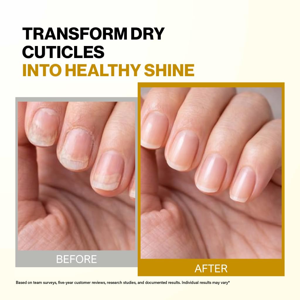 Bee Naturals Nail & Cuticle Oil with Avocado and Castor Oils
