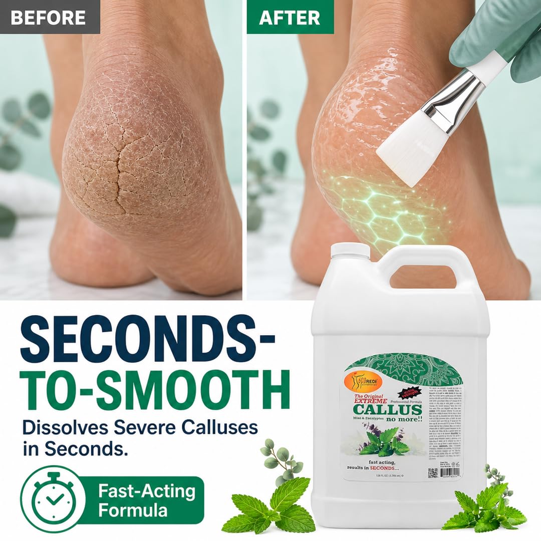 SPA REDI Foot Callus Remover Gel