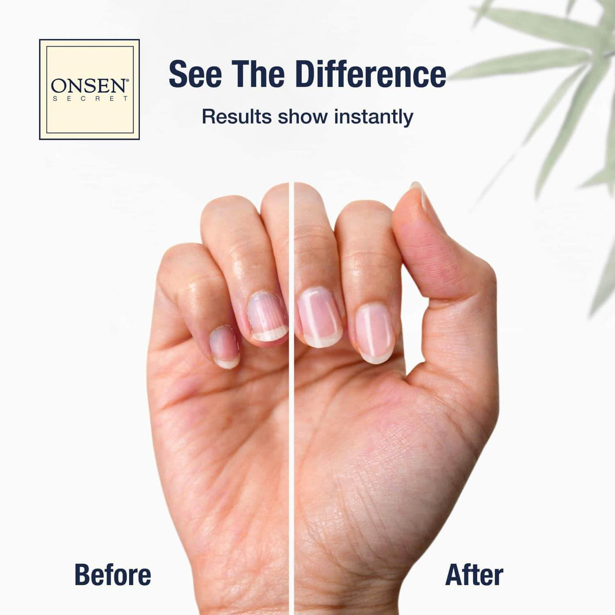 Onsen Secret Nail Care Kit - Nail Strengthening & Shine