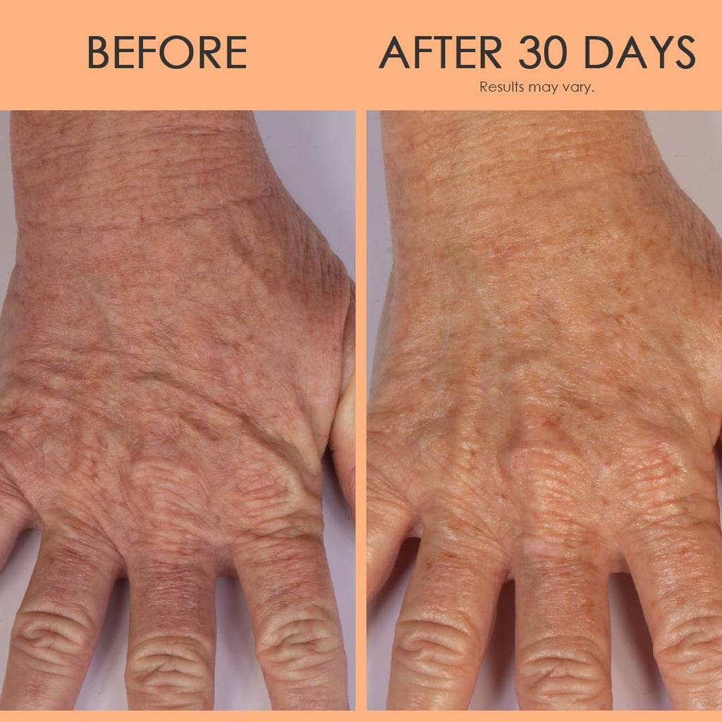 BODY FIRM Crepe Erase Anti-Aging Hand Repair Treatment