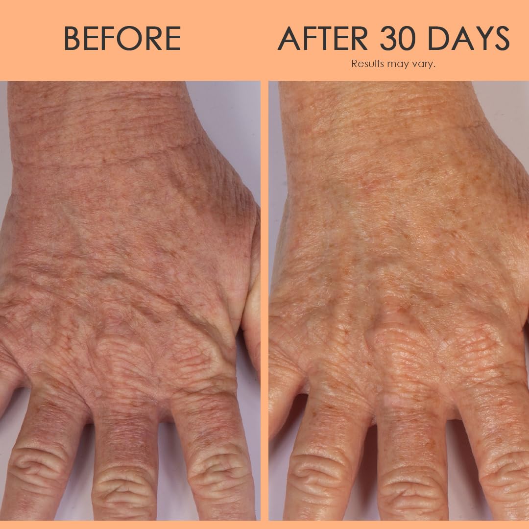 BODY FIRM Crepe Erase Anti-Aging Hand Repair Treatment