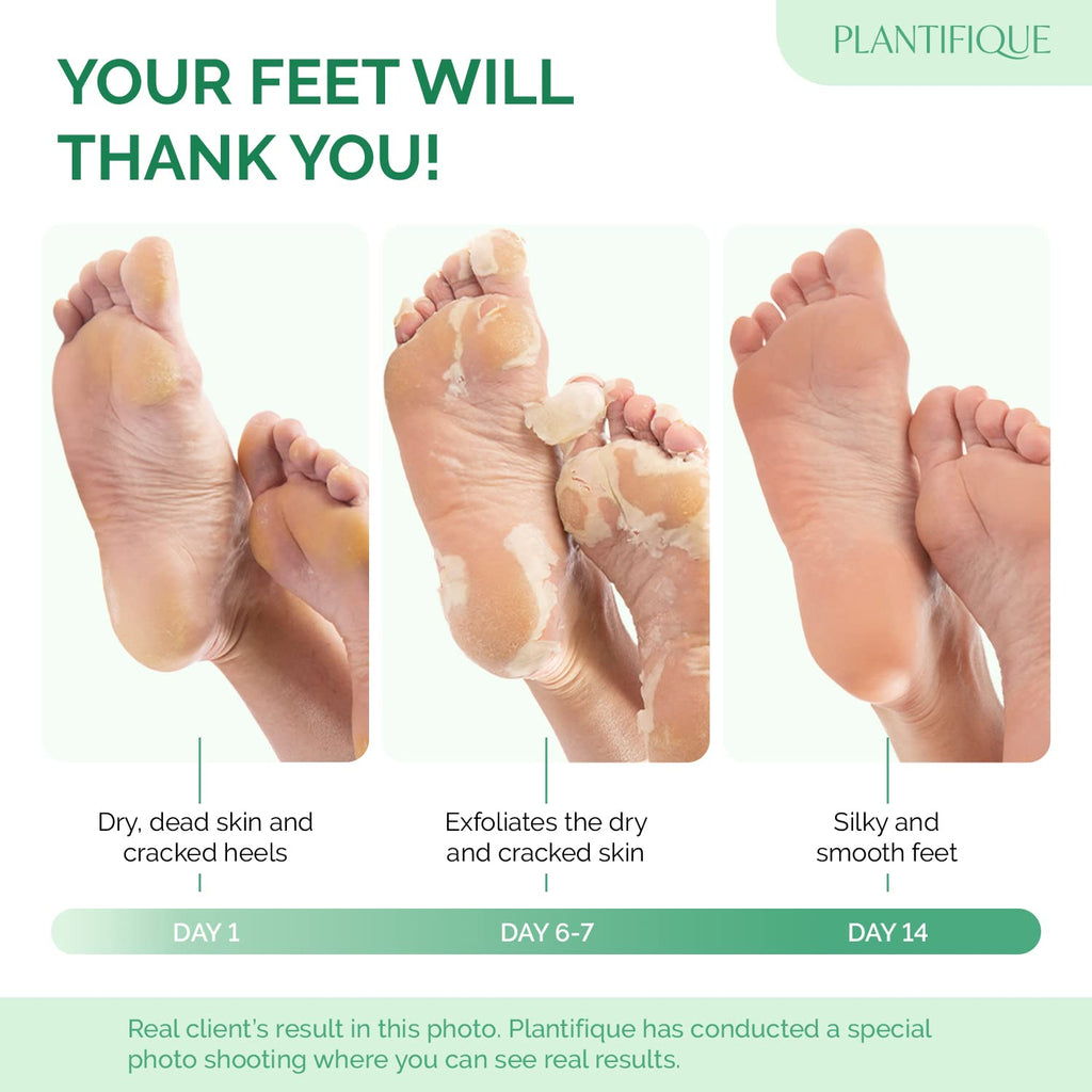 PLANTIFIQUE Foot Peeling Mask, Dermatologically Tested