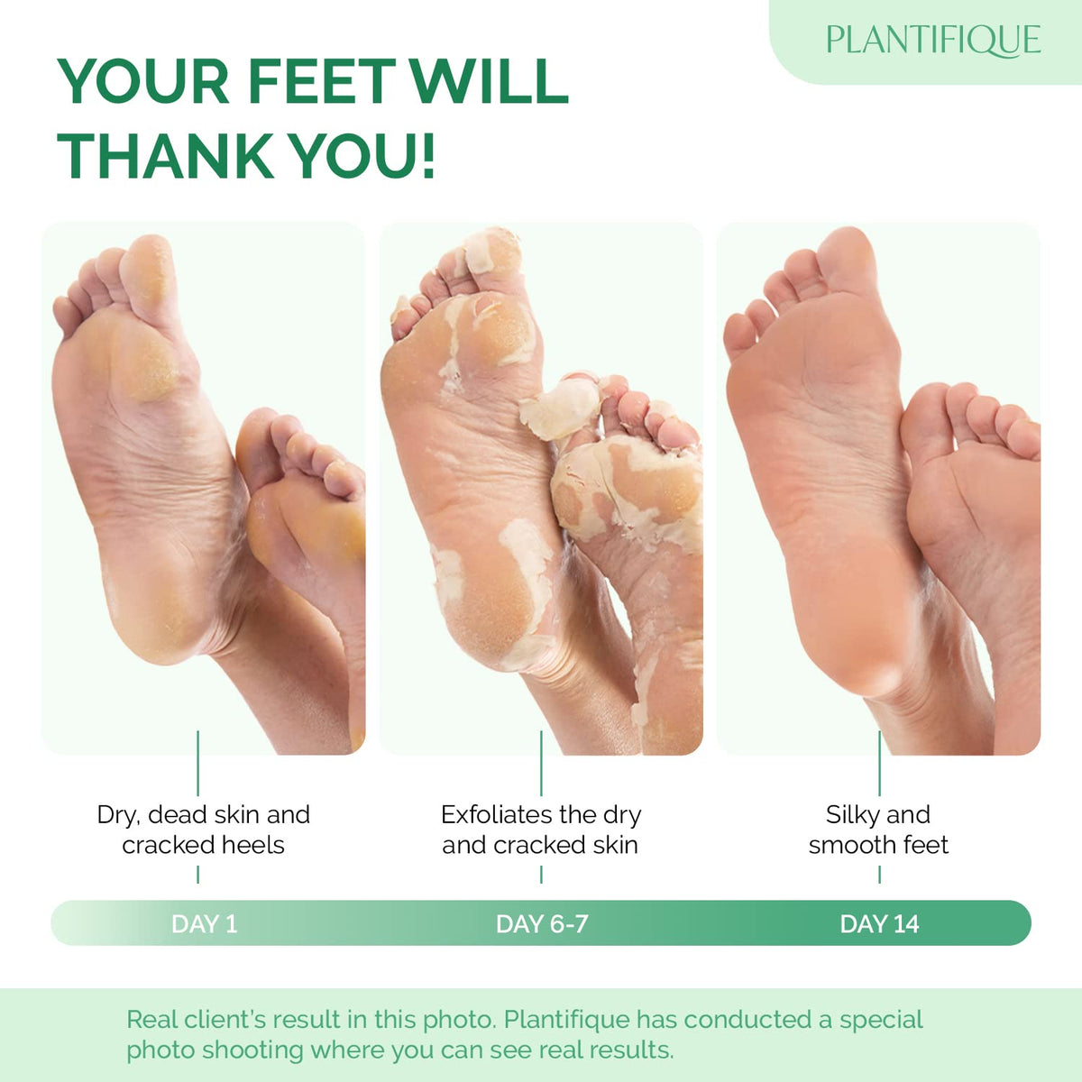 PLANTIFIQUE Foot Peeling Mask, Dermatologically Tested