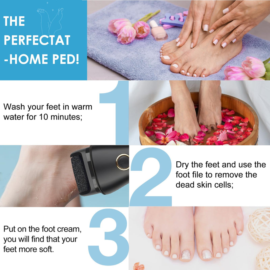 Electric Foot File Callus Remover for Feet