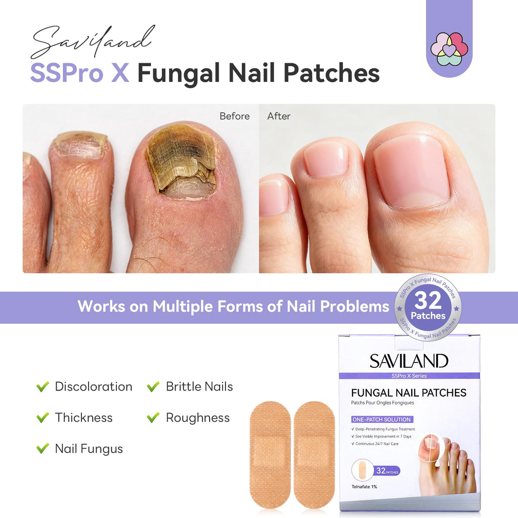 SAVILAND Fungal Nail Patches with 1% Tolnaftate