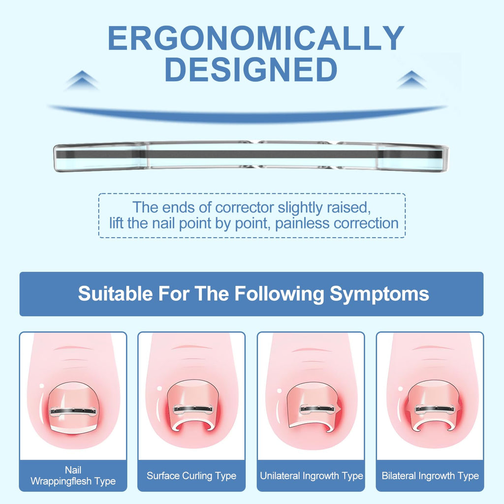 12-Piece Ingrown Toenail Corrector Strips with 4 Sizes