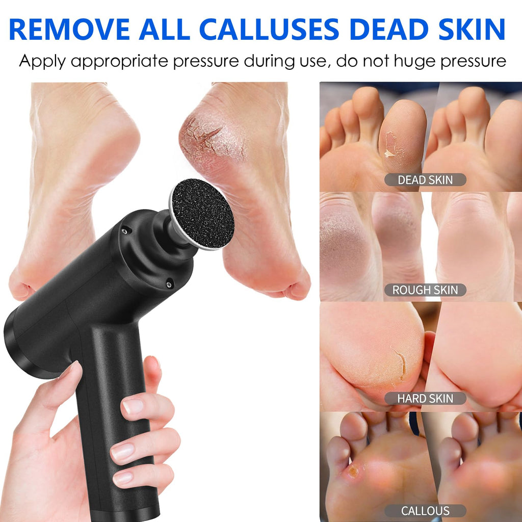 Electric Foot Callus Remover with 10 Adjustable Speeds and 4 Grinding Heads