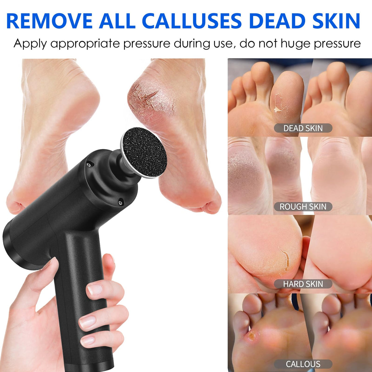 Electric Foot Callus Remover with 10 Adjustable Speeds and 4 Grinding Heads