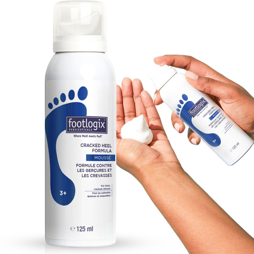 FOOTLOGIX Cracked Heel Formula Mousse with Urea, 4.23 oz