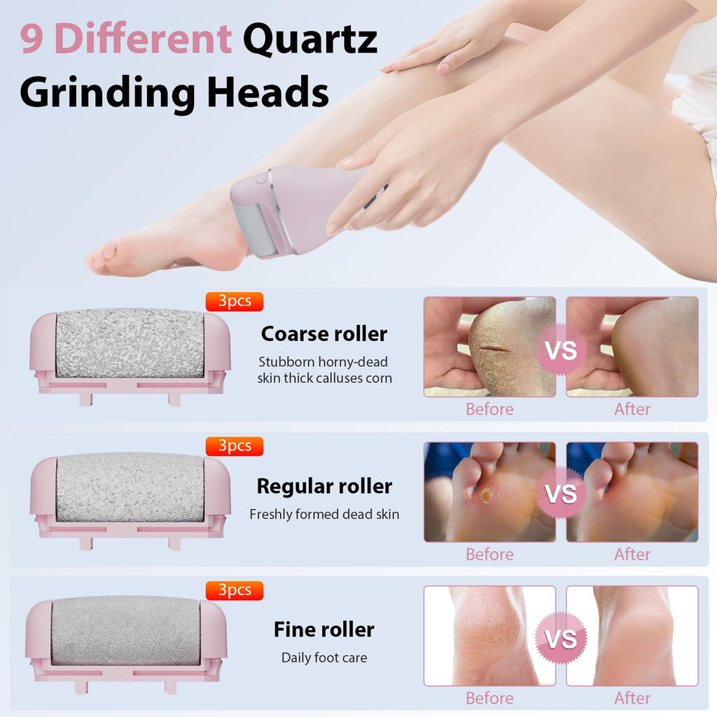 AdamPark Rechargeable Electric Foot Callus Remover, Wet/Dry Foot File