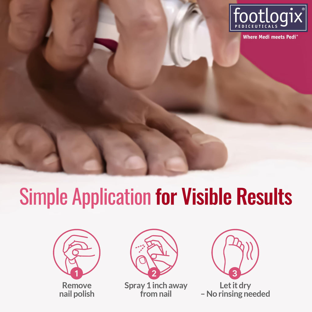 Footlogix Nail Tincture Spray with Spiraleen, Tea Tree Oil & Panthenol