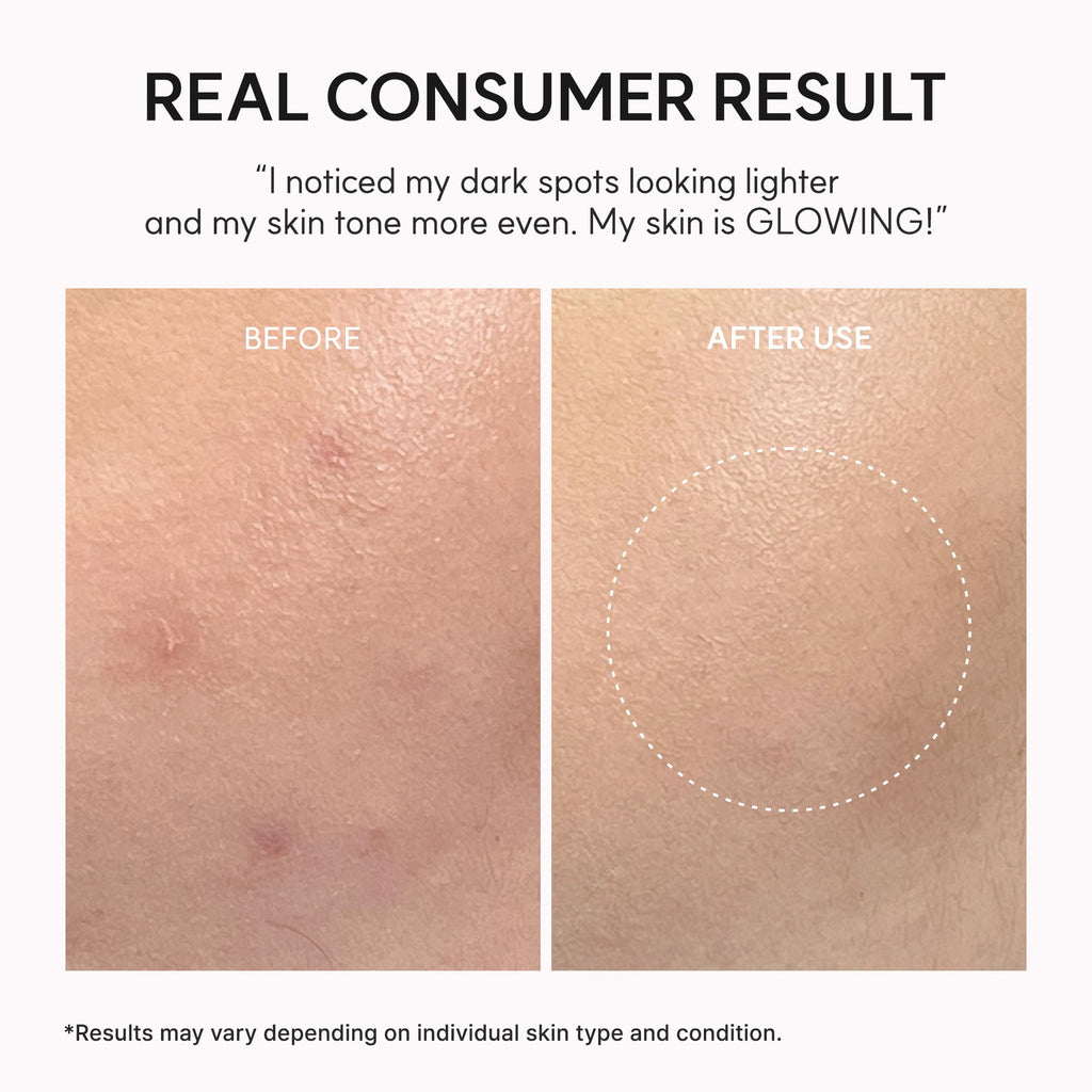 Arencia Skincare Serum