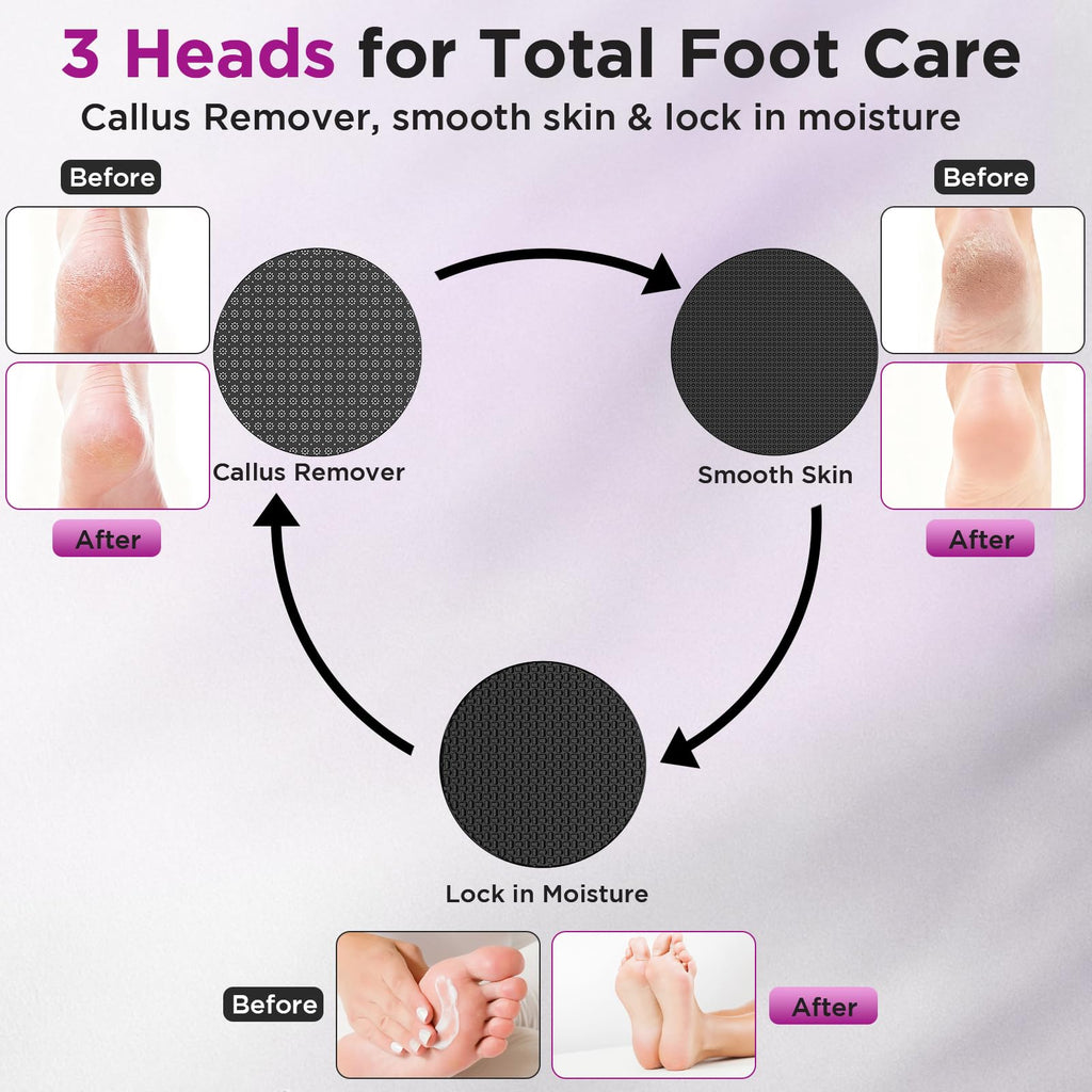 Electric Foot Callus Remover with Nano-Glass Heads