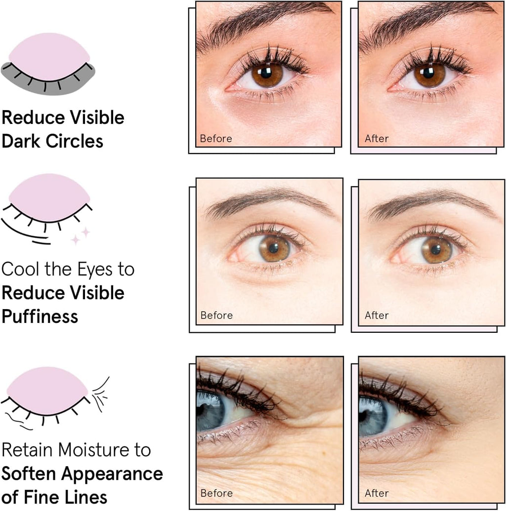 grace & stella Vegan Under Eye Patches with Niacinamide