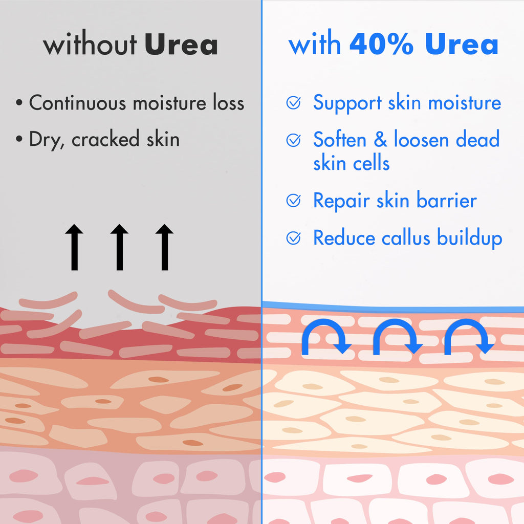 Ebanel Urea 40% Cream with Salicylic Acid 2% for Dry, Rough Skin