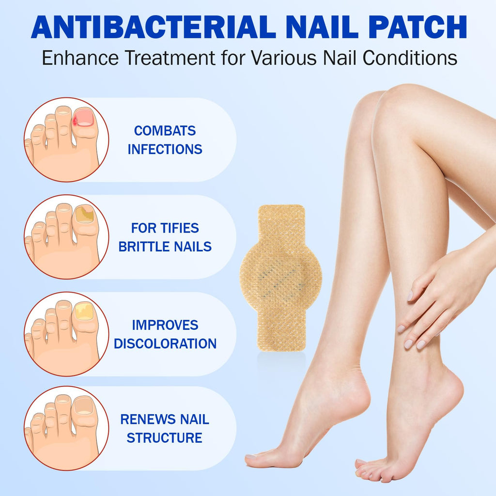 Toenail Repair Patches – Overnight Nail Care