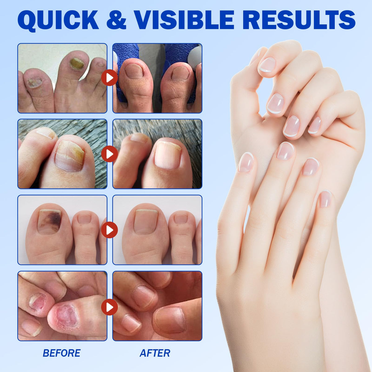 Toenail Repair Patches – Overnight Nail Care