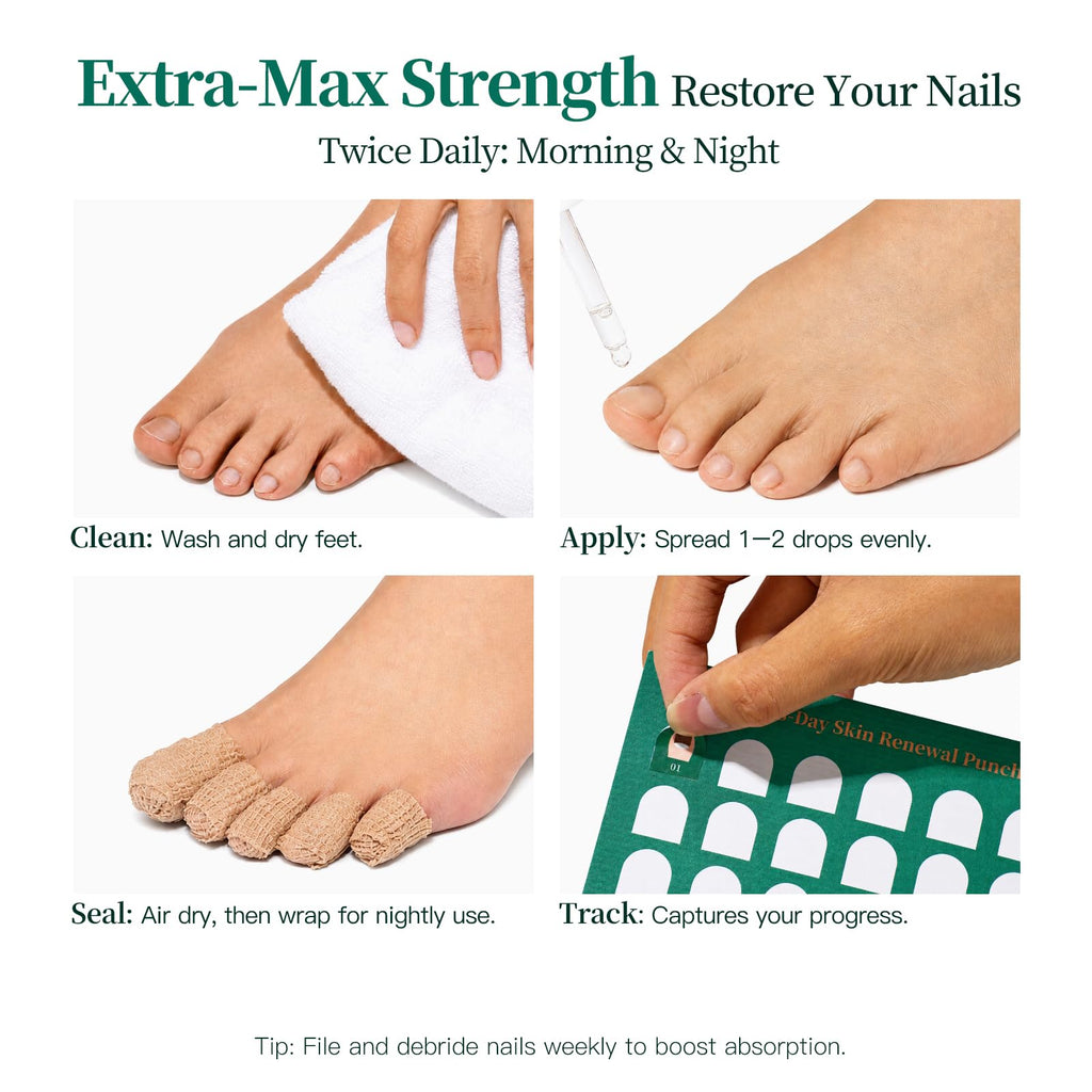 Apuree Extra Strength Toenail Fungus Treatment, 25% Undecylenic Acid + 1% Tolnaftate