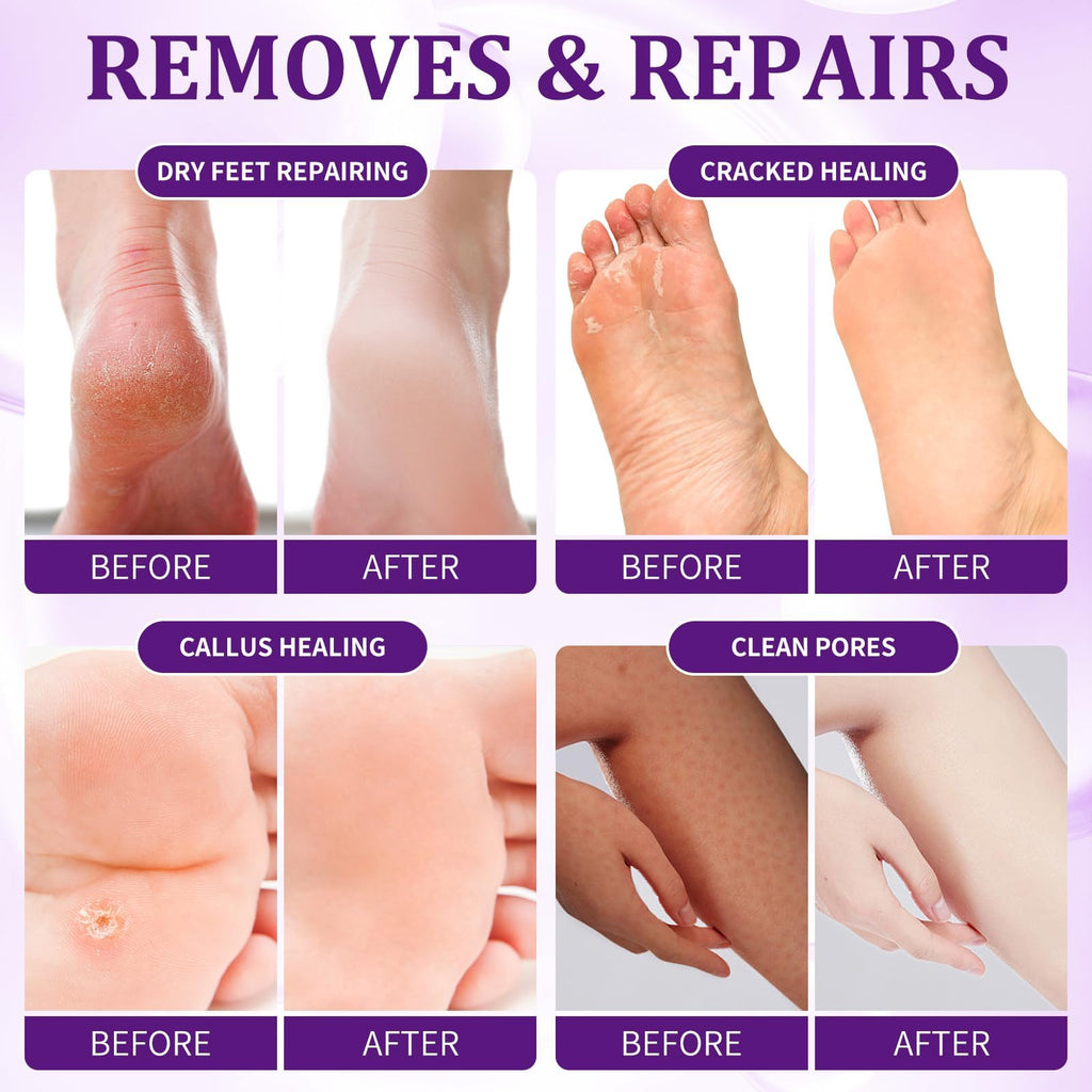 Pedicure Foot Spa Kit, 4-Step Foot Care Set