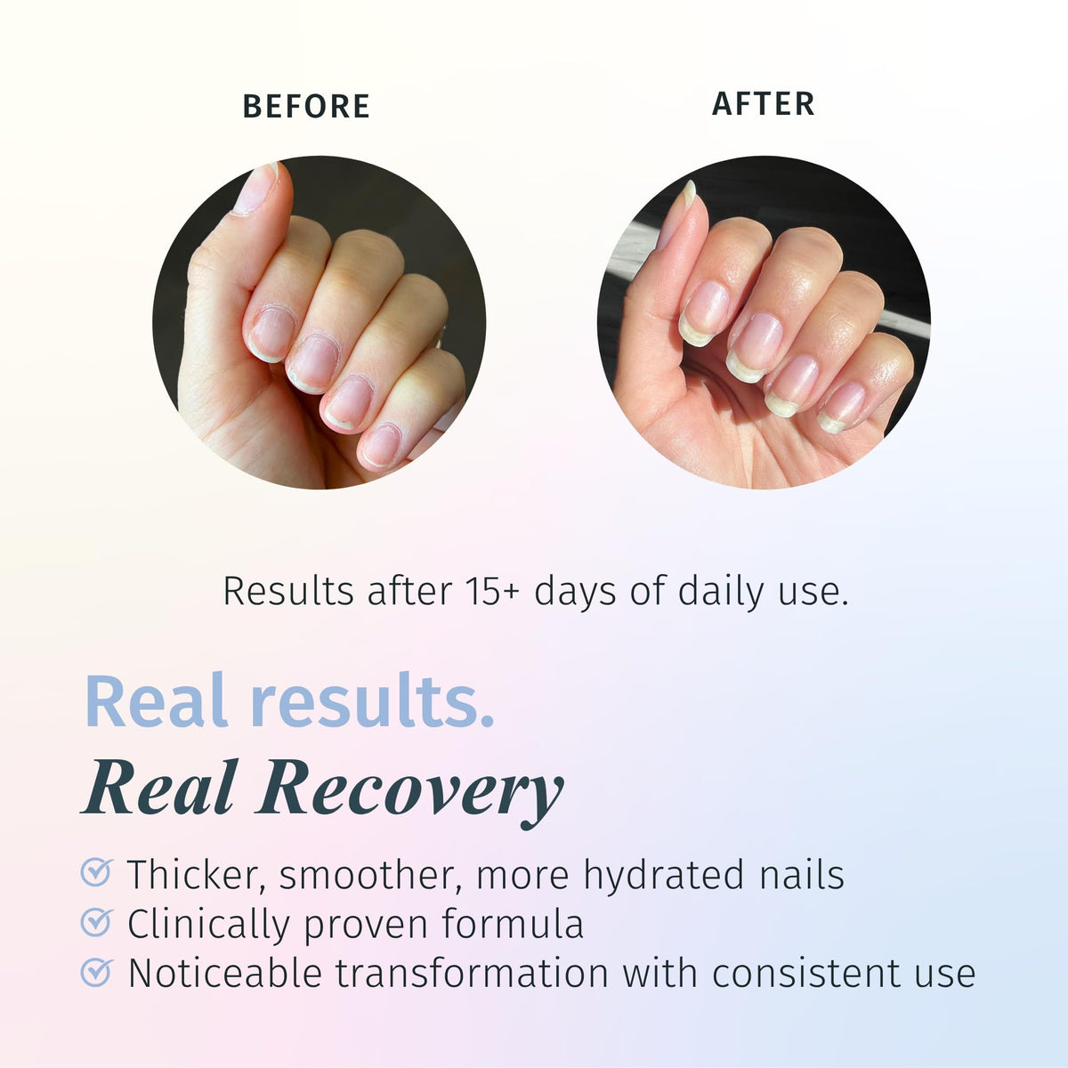 duri Rejuvacote 1 Nail Growth System Nail Strengthener