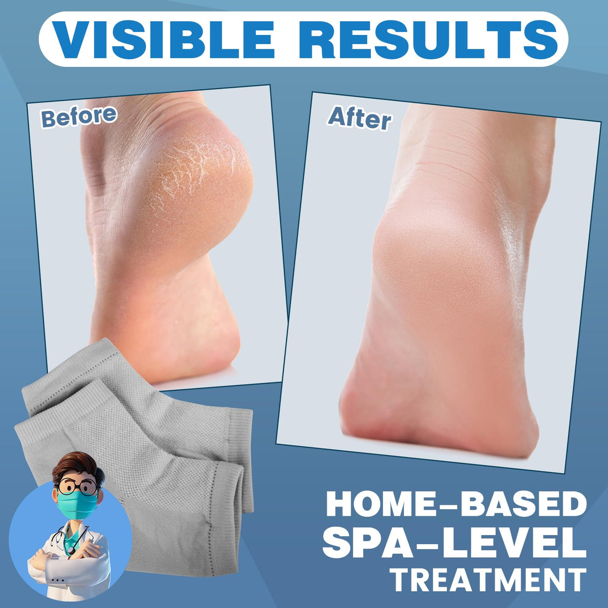 TEAWOO Moisturizing Toeless Heel Socks for Dry, Cracked Feet