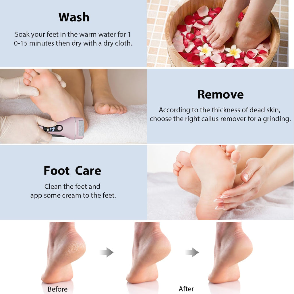 AdamPark Rechargeable Electric Foot Callus Remover, Wet/Dry Foot File