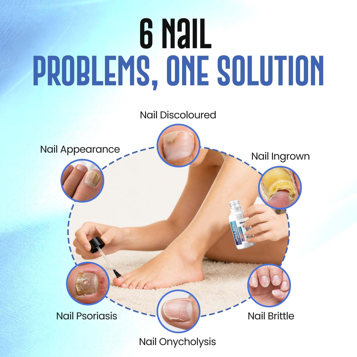 Urea Nail Care Gel for Thick Nails and Callused Skin