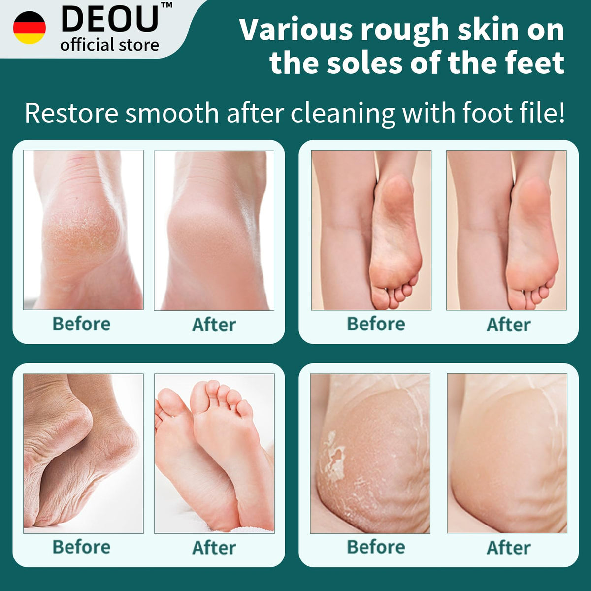 DEOU Black Metal Foot File with 304 Stainless Steel Surface