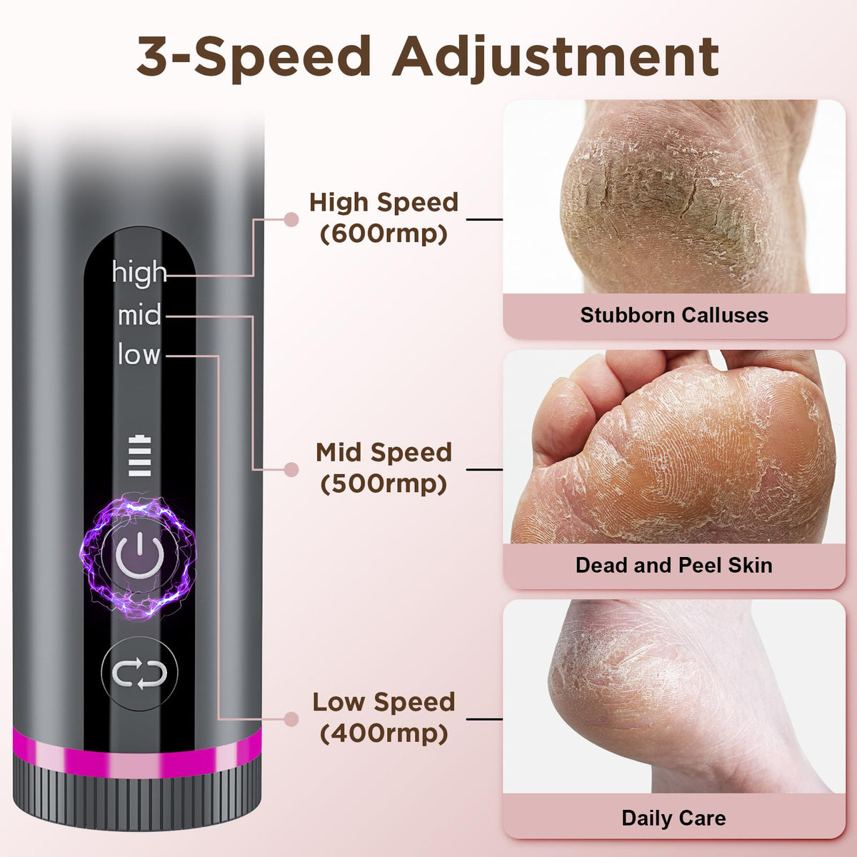 Electric Foot Callus Remover with Nano-Glass Head and Sandpaper Discs