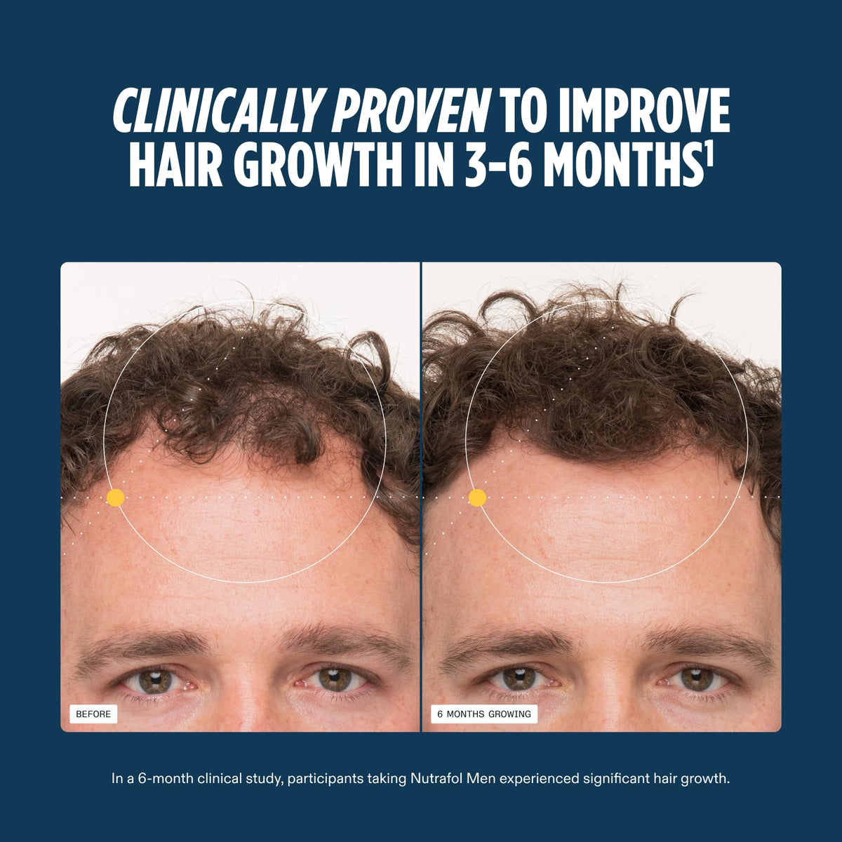 Nutrafol Men's Hair Growth Supplements for Thinning Hair