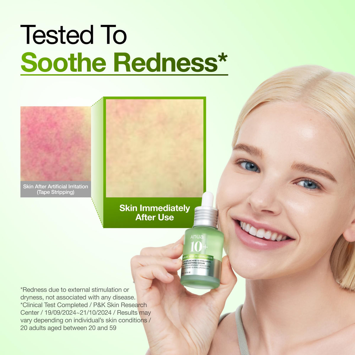 Anua Azelaic Acid 10 Hyaluron Redness Soothing Facial Serum