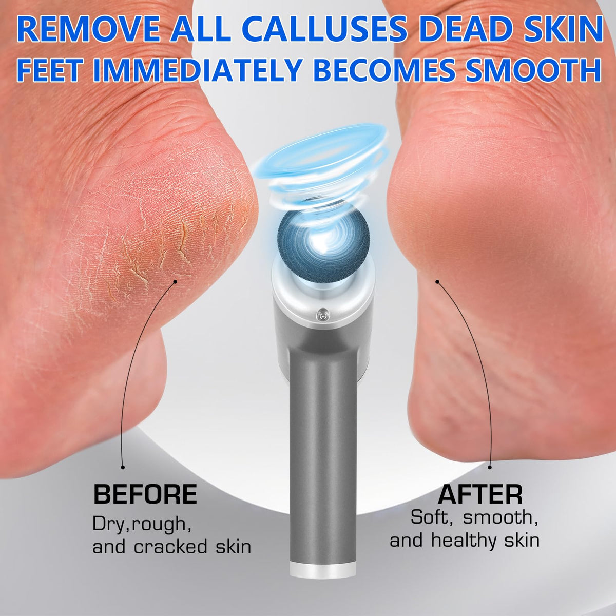 Upgraded Electric Callus Remover for Feet, 4500 RPM Foot Sander