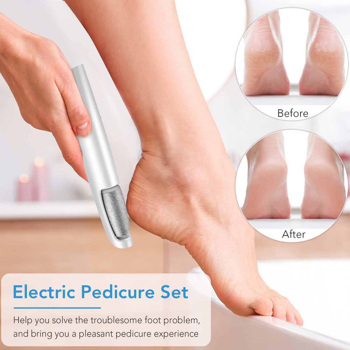 LINKEVAP Electric Foot Callus Remover Pedicure Kit