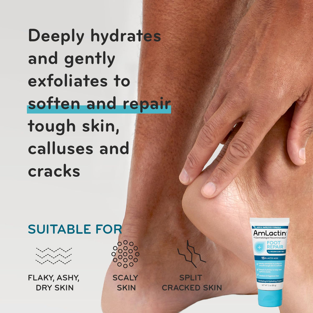 AmLactin Essentials Lactic Acid Skin Care Set
