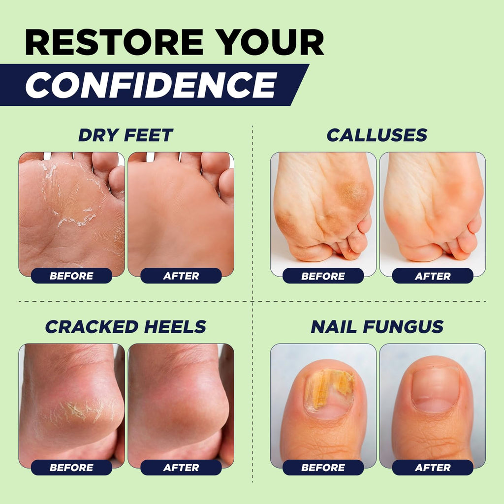 Foot Care Combo Set for At-Home Pedicure Routines