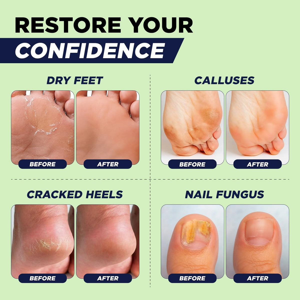 Foot Care Combo Set for At-Home Pedicure Routines