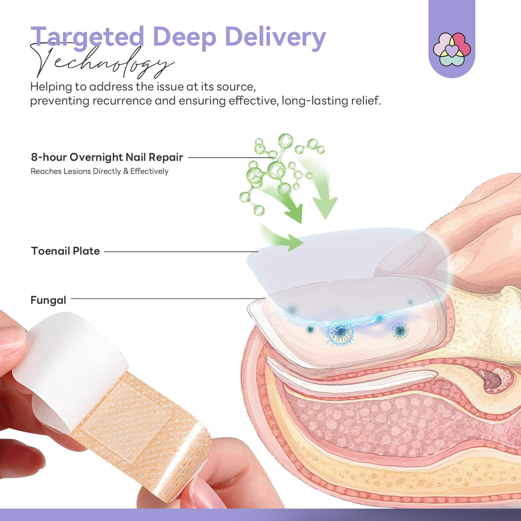 SAVILAND Fungal Nail Patches with 1% Tolnaftate